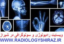 تصویر از قیمت و تعرفه خدمات رادیولوژی و سونوگرافی 1402 در شیراز