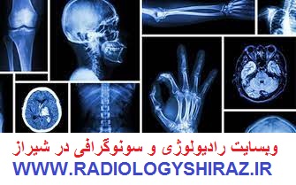 تصویر از لیست مراکز رادیولوژی و سونوگرافی در شیراز